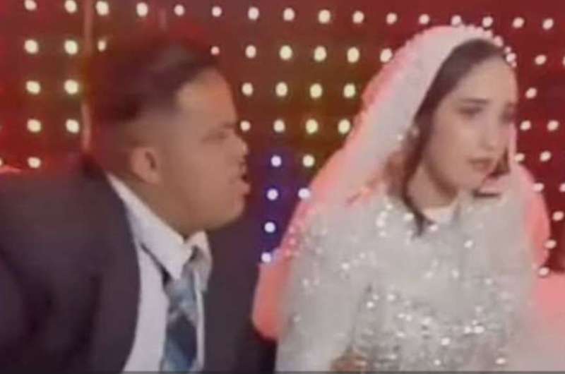 بعد واقعة عريس متلازمة داون.. طبيب نفسي يوضح شروط زواج ذوي الهمم