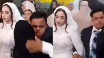 بعد واقعة عريس متلازمة داون..طبيب نفسي يوضح الحالات التي يمنع فيها الزواج