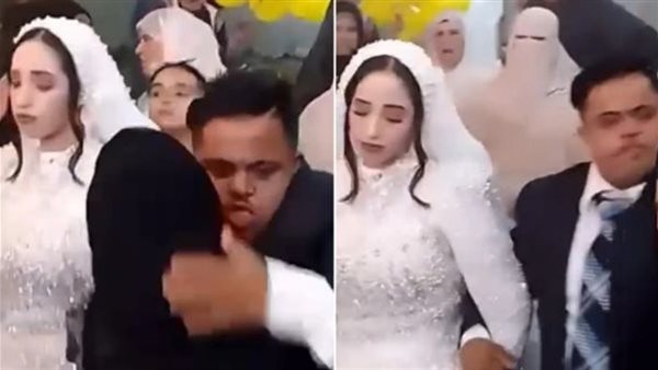 بعد واقعة عريس متلازمة داون..طبيب نفسي يوضح الحالات التي يمنع فيها الزواج