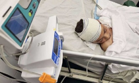 إيطاليا تستقبل الطفل آدم النجار بعد استشهاد أخوته التسعة بغارة إسرائيلية في غزة