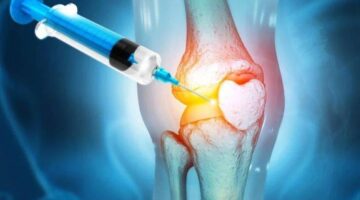 أضرار حُقن الكورتيزون للركبة.. أكثر من فائدتها على المدى الطويل – أخبار السعودية
