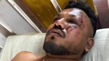 الناجي الوحيد.. «راميش» يروي للعالم تفاصيل كارثة الطائرة الهندية – أخبار السعودية