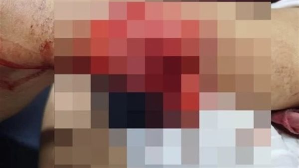 بسبب الخلاف على ثمن المشتريات.. 3 أشخاص يمزقون جسد بائع داخل سوبر ماركت بالهرم