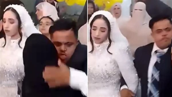 عاجل.. زفاف مصاب بمتلازمة داون يثير الجدل..”المأذونين الشرعيين” يوضح لـ”مصر تايمز” الحكم الشرعي