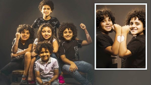 جلده مختلف لكنه جميل.. كيف أُهيئ طفلي المصاب بالبهاق لمواجهة المجتمع؟
