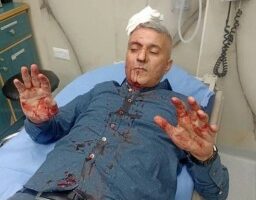 إعتداء على صحفي أردني من ” 4 ” ملثمين مجهولين ” صور “