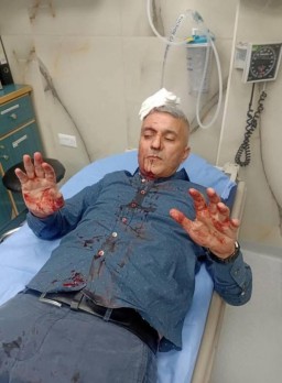 إعتداء على صحفي أردني من ” 4 ” ملثمين مجهولين ” صور “